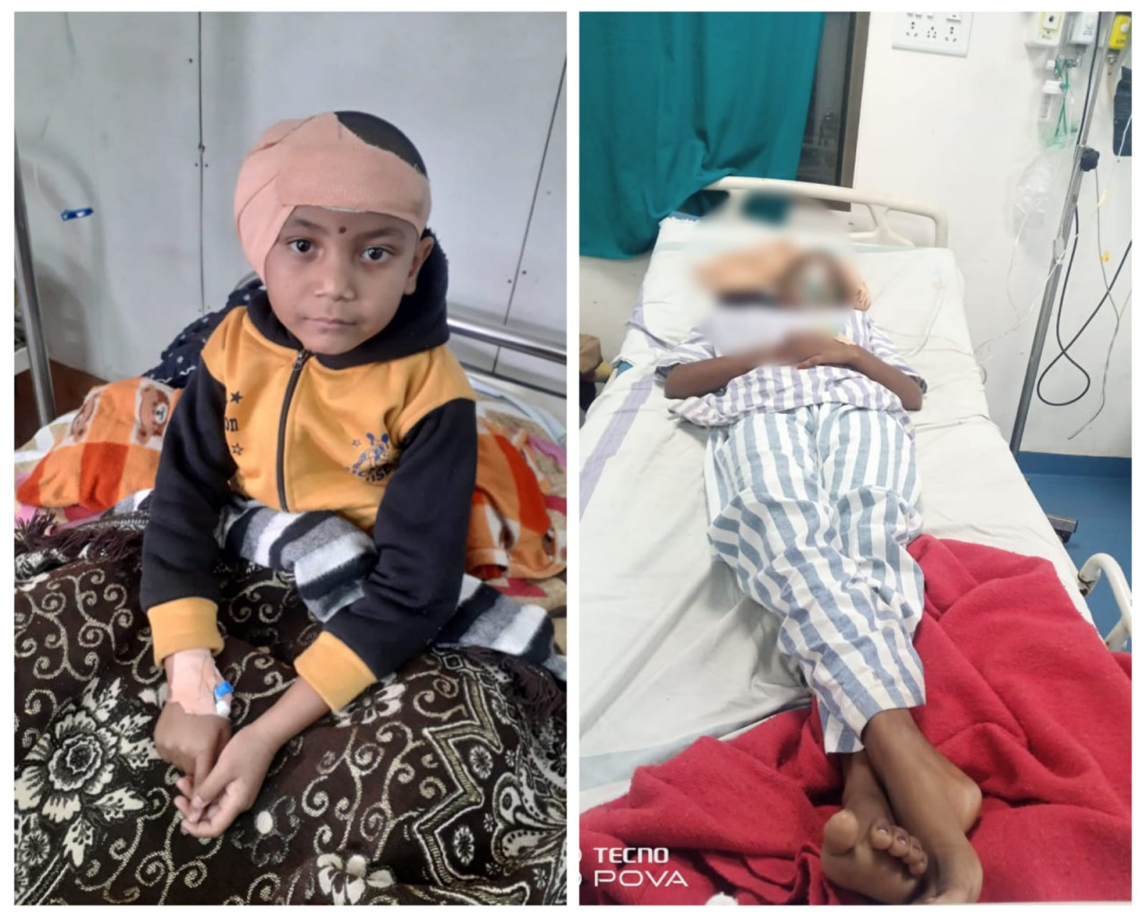 चिरायु योजना से संवर रही है जिंदगी,6 वर्षीय श्रेया अब सुन पाएगी आवाज