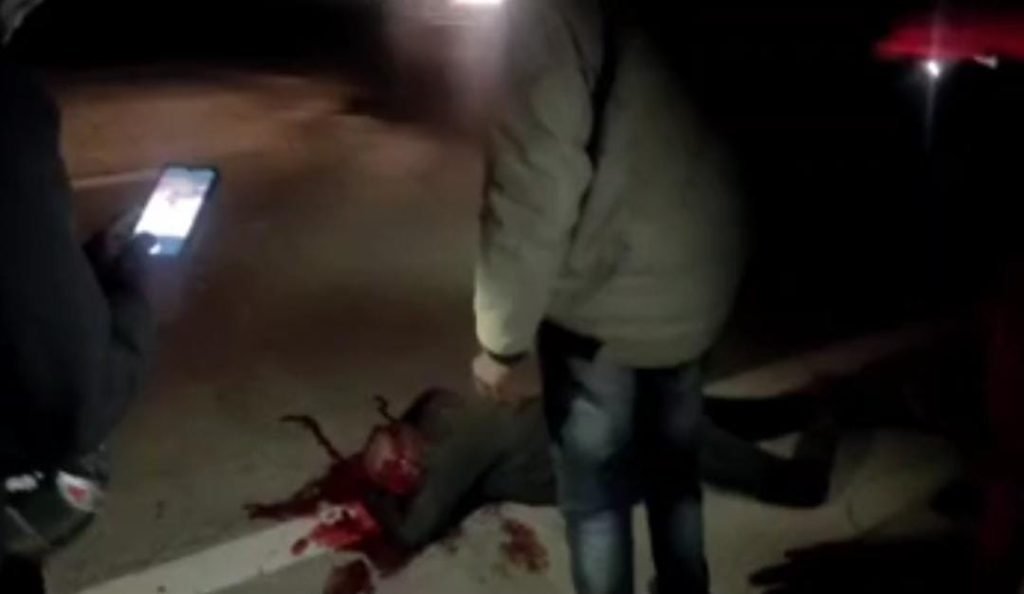 भाजपा प्रत्याशी चिंतामणि महाराज की गाड़ी से टकराए बाइक सवार, तीनो घायल को रायपुर रेफर।