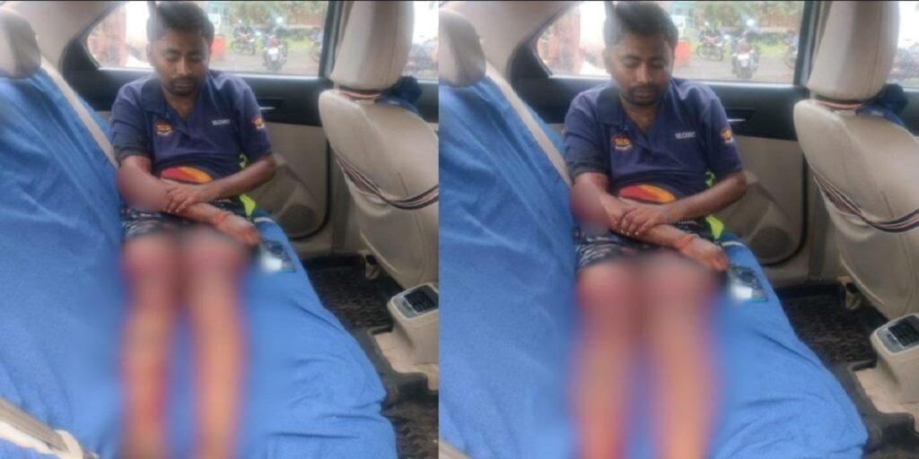 CG Crime: चॉइस सेंटर में चाकूबाजी, संचालक घायल