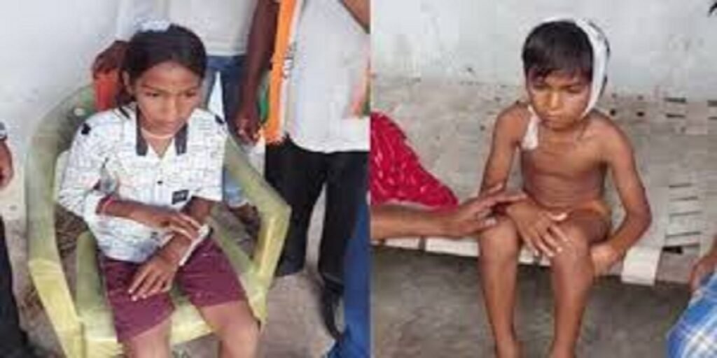 BREAKING : शाला भवन के छत का प्लास्टर गिरा, एक छात्रा का सिर फटा, तो दूसरी हुई घायल…