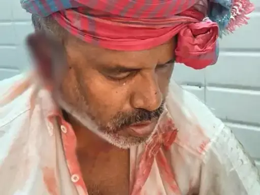 Robbery case: कबाड़ी व्यवसायी से हुई लूटपाट, दो अज्ञात बदमाशों ने किया हमला