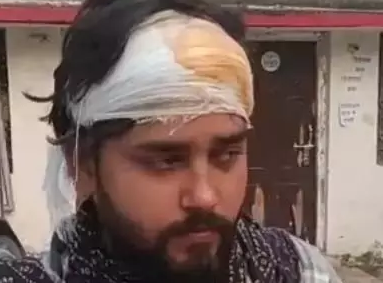 Hammer Attack: मिनोचा कॉलोनी में उपद्रव, गाड़ी में तोड़फोड़ रोकने पर हमला
