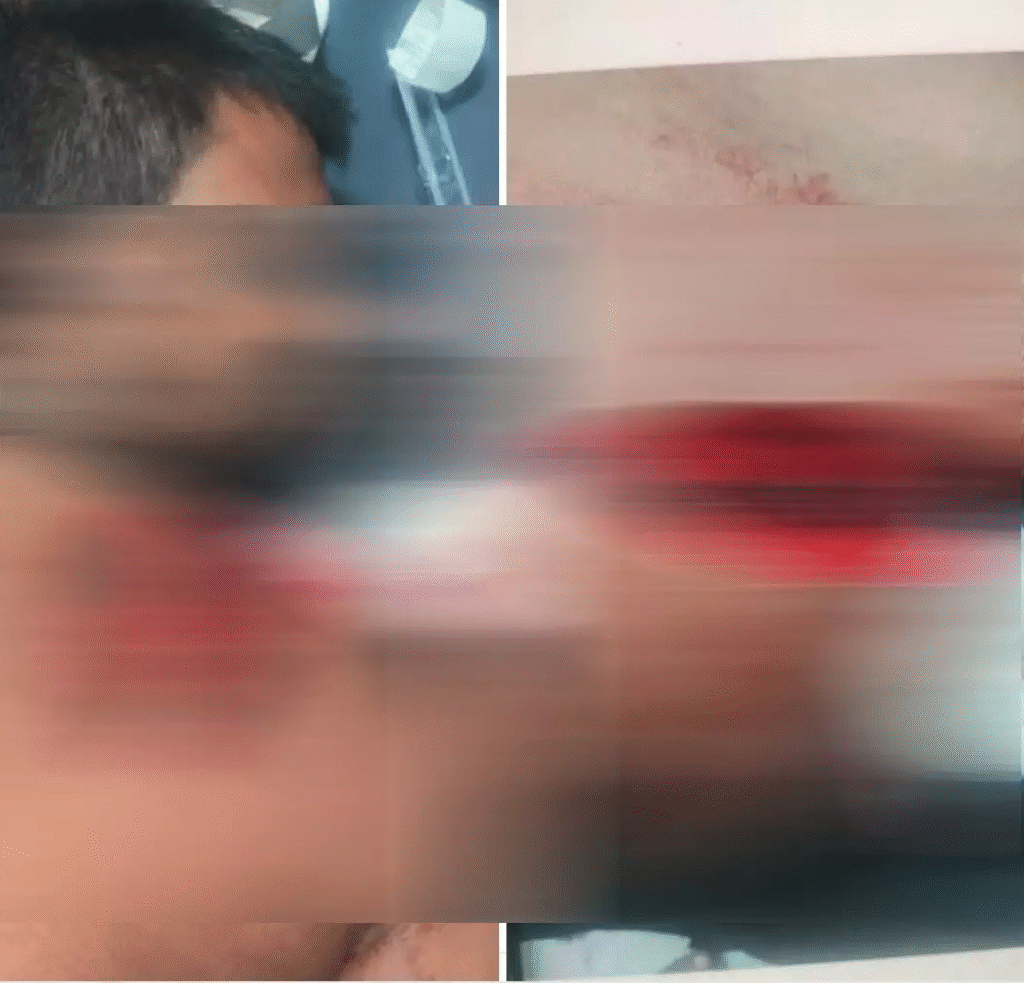 urla knife attack: उरला में होटल संचालक पर हमला, पुलिस ने मामला दर्ज कर शुरू की जांच