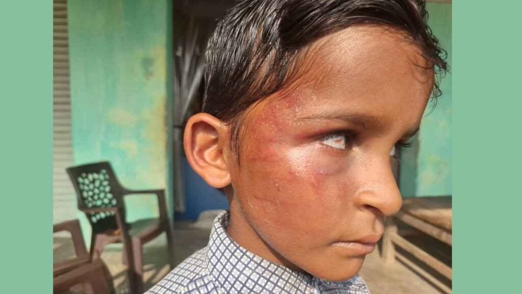 Teacher Spanking : दूसरी कक्षा के मासूम छात्र की बेरहमी से पिटाई