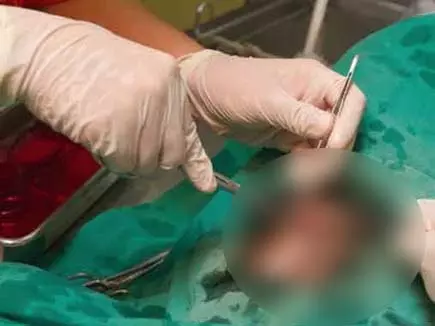 Medical Negligence : ऑपरेशन टेबल पर बिगड़ी तबीयत, नसबंदी करा रही दो महिलाओं की दर्दनाक मौत Medical Negligence