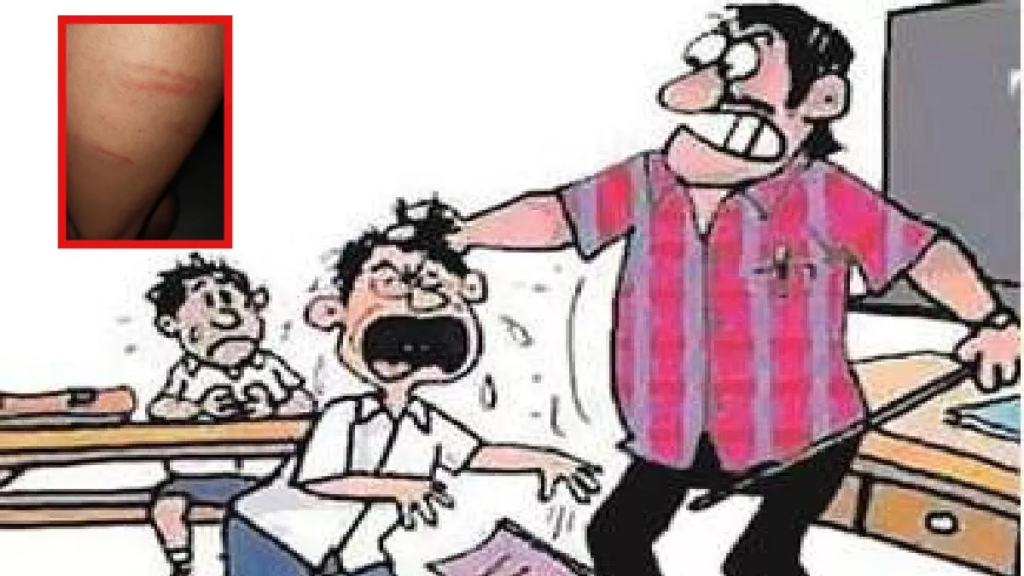 CG News : क्रिकेट बॉल के विवाद में प्राचार्य की हैवानियत, मासूमों के शरीर पर चोट के निशान