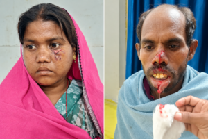 कुत्ते के काटने से दो घायल